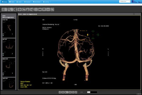 Medical Imaging